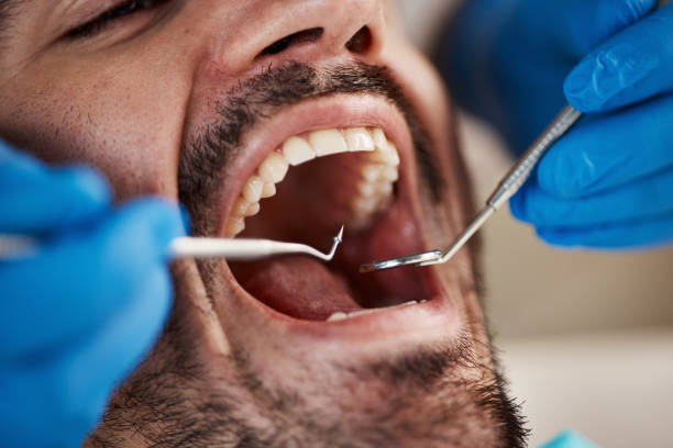 Best Walk-In Emergency Dentist in Columbus, OH