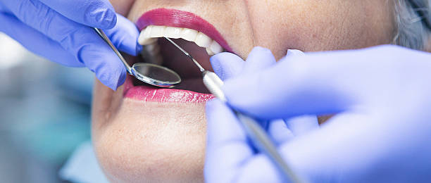 Best Emergency Dental Surgery in Columbus, OH
